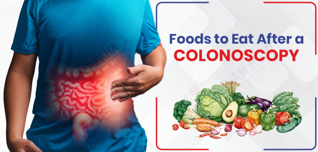 Foods to Eat After a Colonoscopy