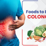 Foods to Eat After a Colonoscopy